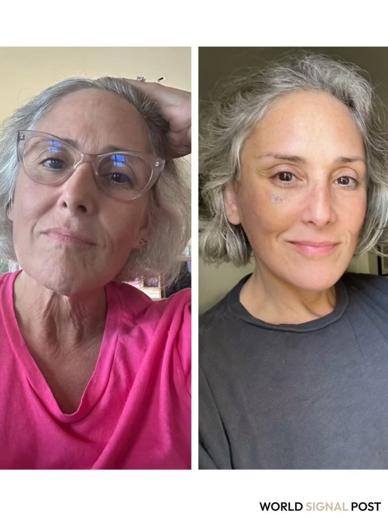 Ricki Lake Celebrates Two Years Post-Facelift with Unfiltered Photos